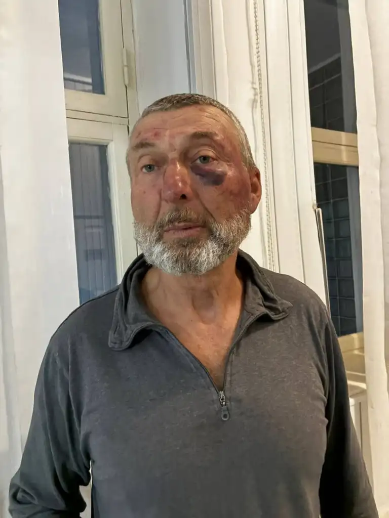 У Рівненській області розслідують обставини інциденту за участю 61-річного майора у відставці та учасника бойових дій в Афганістані. Поліція відкрила кримінальне провадження, а обласний ТЦК та СП призначив службову перевірку.