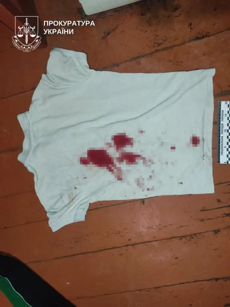 На Рівненщині судитимуть чоловіка, який через борг завдав знайомому тяжких ножових поранень